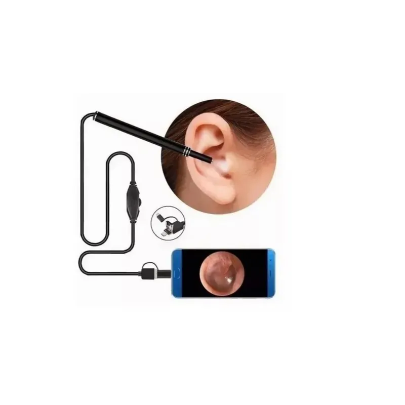 GENERICO - Otoscopio Digital Cámara De Oídos Para Usar En Pc Y Celular Negro