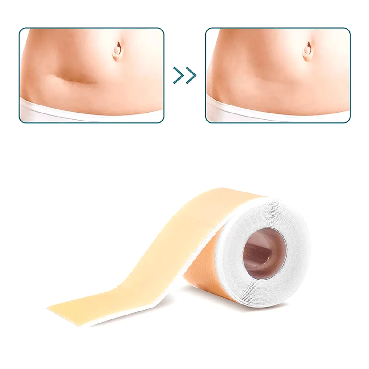 GENERICO - Parche de Silicona para Cicatrices y Queloides Rollo 4cm * 1,5 metros