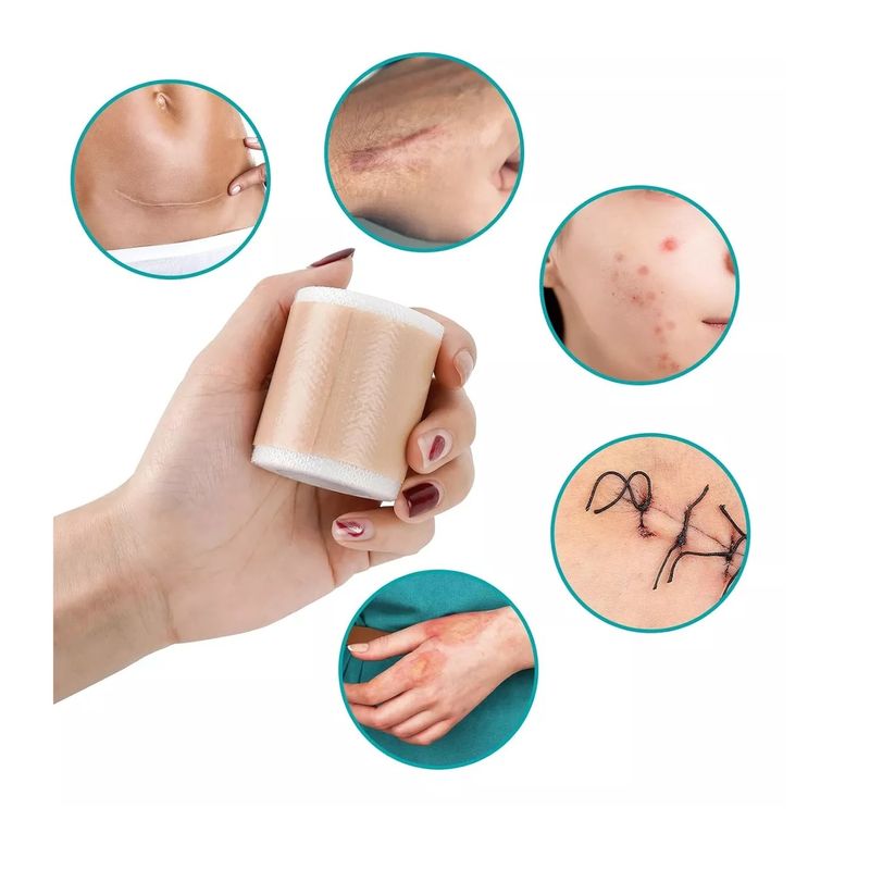 GENERICO - Parche Para Cicatrices Queloides Gel Rollo De 4cmx1m Heridas