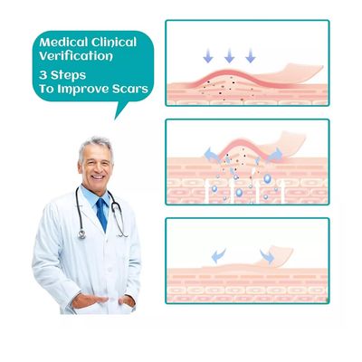 Imagen 2 del producto Parche Para Cicatrices Queloides Gel Rollo De 4cmx1m Heridas