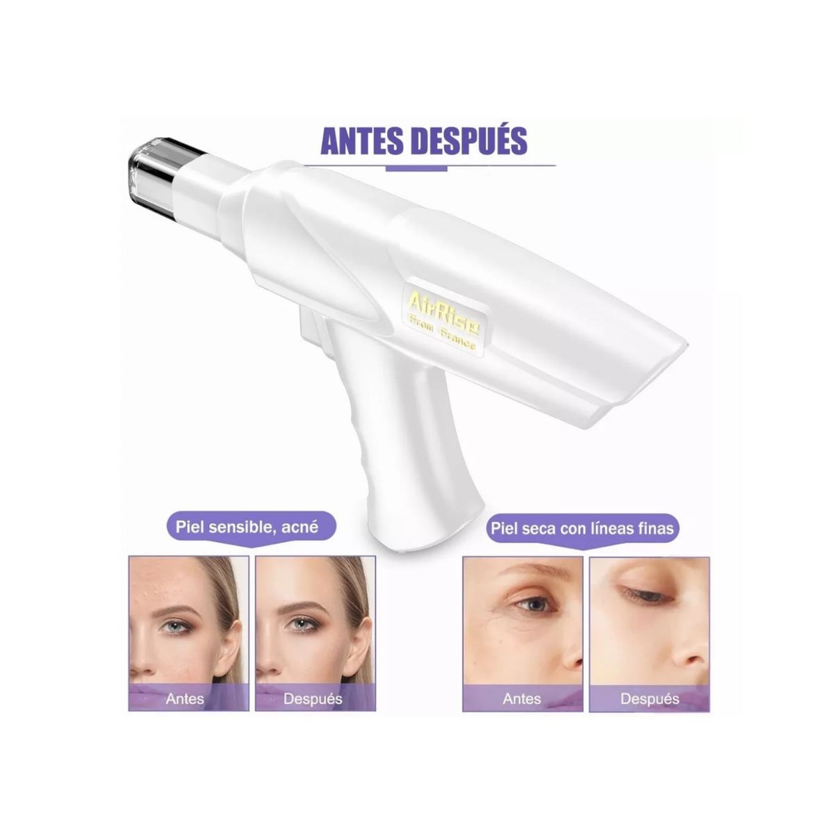 GENERICO - Pistola De Mesoterapia De Belleza Inalámbrica