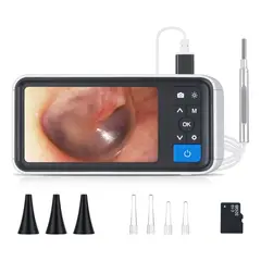 U BUY - Otoscopio Digital De Alta Definición De 39 Mm