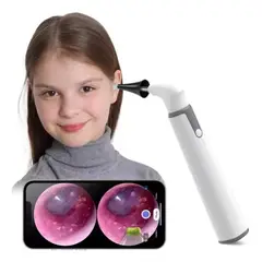 GENERICO - Otoscopio Inalámbrico Wifi Cámara Oído Luz Led Recargable