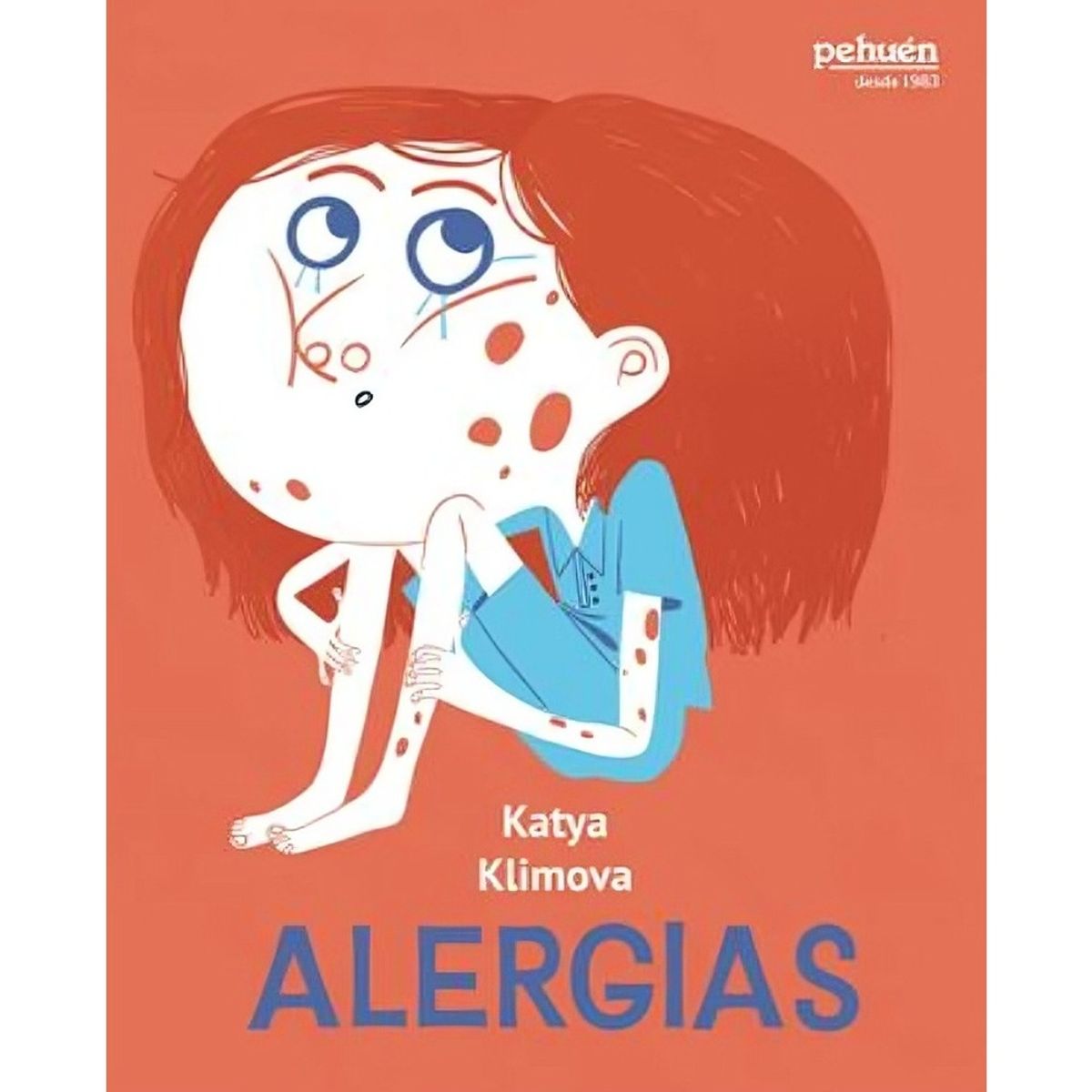 TOP10BOOKS - LIBRO Alergias - Alergias