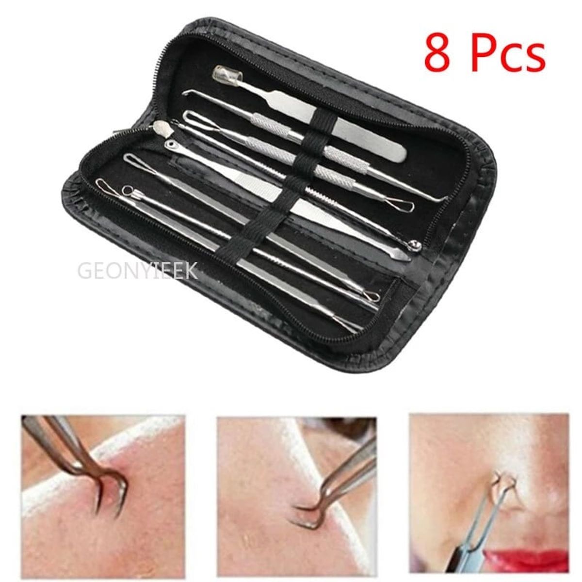 GENERICO - Kit Pinzas Herramientas Removedor Acne Punto Negro Extractor 8 Piezas