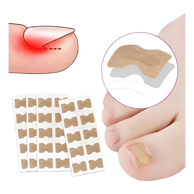 GENERICO - Pack 100 Parches Correctores Reparador De Uñas Encarnadas