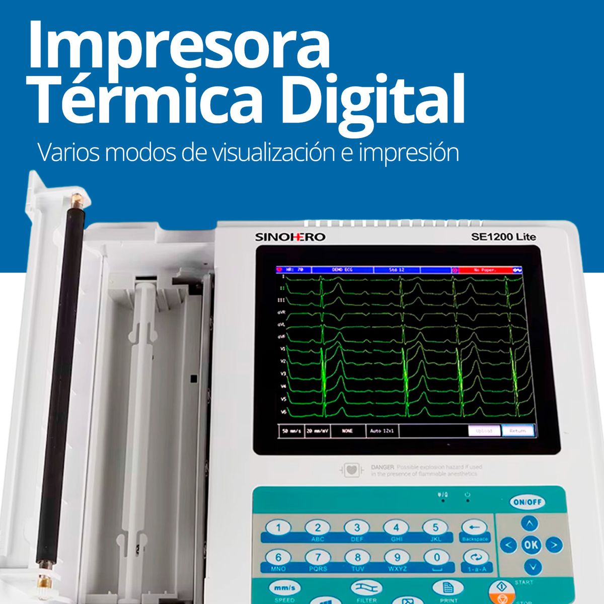 SINOHERO - Electrocardiógrafo Sinohero ECG SE1200 Lite 12 Canales con Pantalla Táctil Conectividad USB