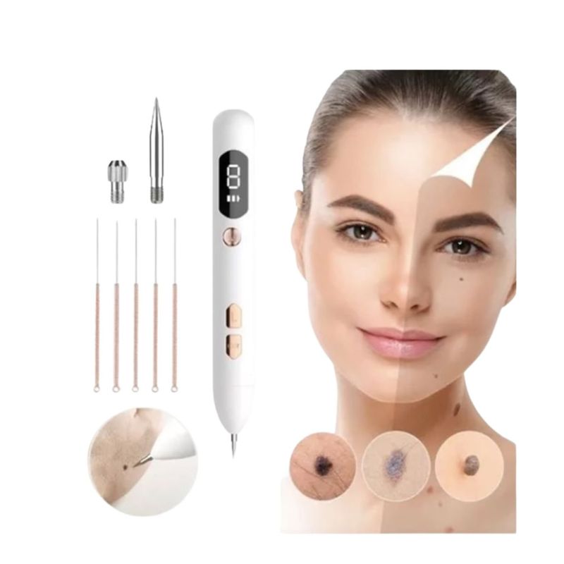 GENERICO - Removedor Acne Puntos Negros 5 Agujas 17cm Mole Spot Beauty