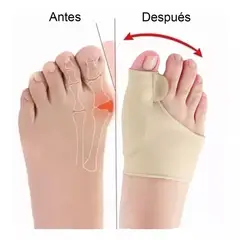 EDWINAYY - Corrector De Juanetes Separador Protector De Ambos Pies