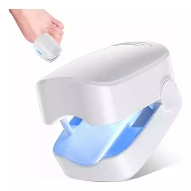 MUNDO MAGIA - Laser Para Quitar Hongos De Las Uñas Onicomicosis Láser