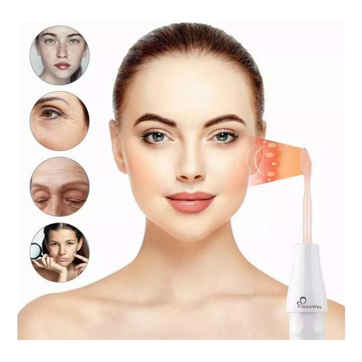 OEM - ALTA FRECUENCIA TERAPIA FACIAL ELIMINA MANCHAS