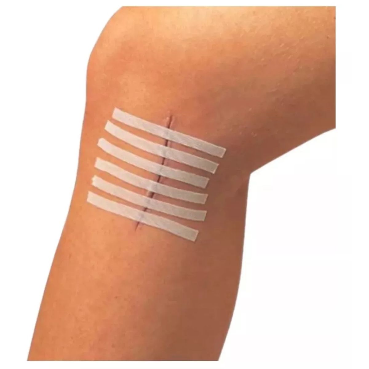 GENERICO - Sutura Adhesiva Heridas Steri Strip 6mm X 100mm 15 Tiras