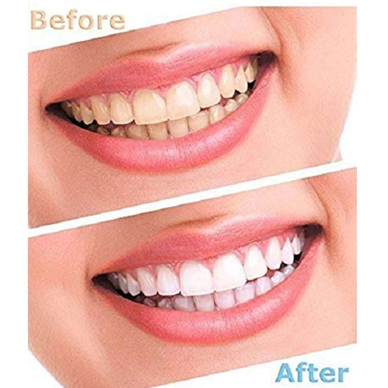 MOVI - BLANQUEADOR DENTAL LUMA SMILE