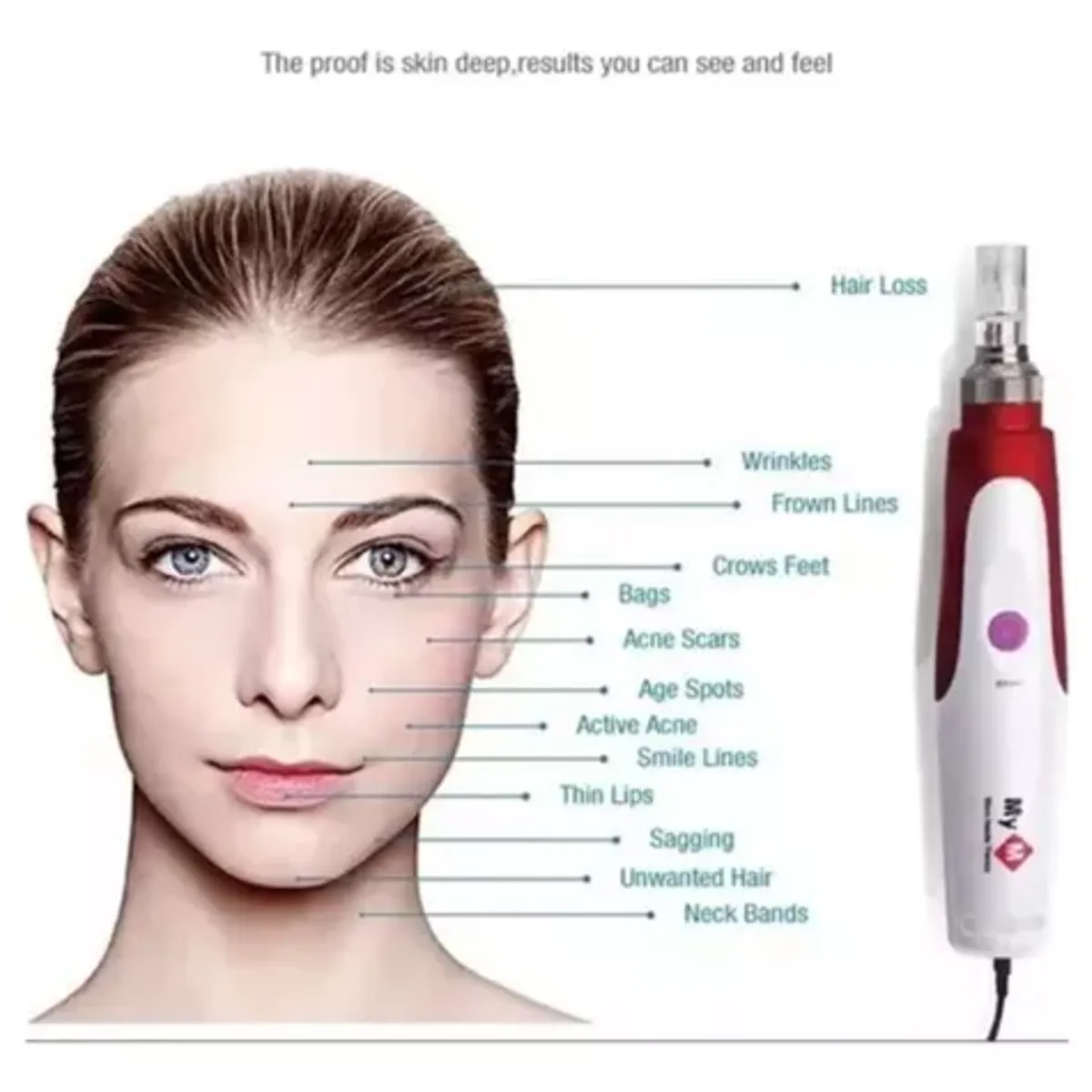 MOVI - Dermapen Facial MyM con 5 Velocidades y 2 Repuestos