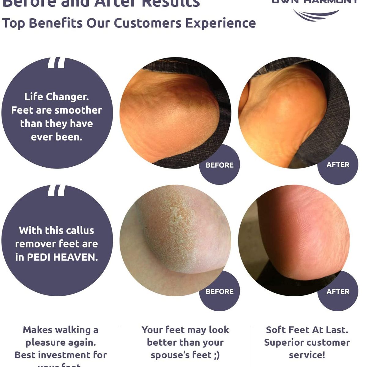 PUREPOWER - Eliminador de callos recargable Con kit de pedicura Para piel muerta