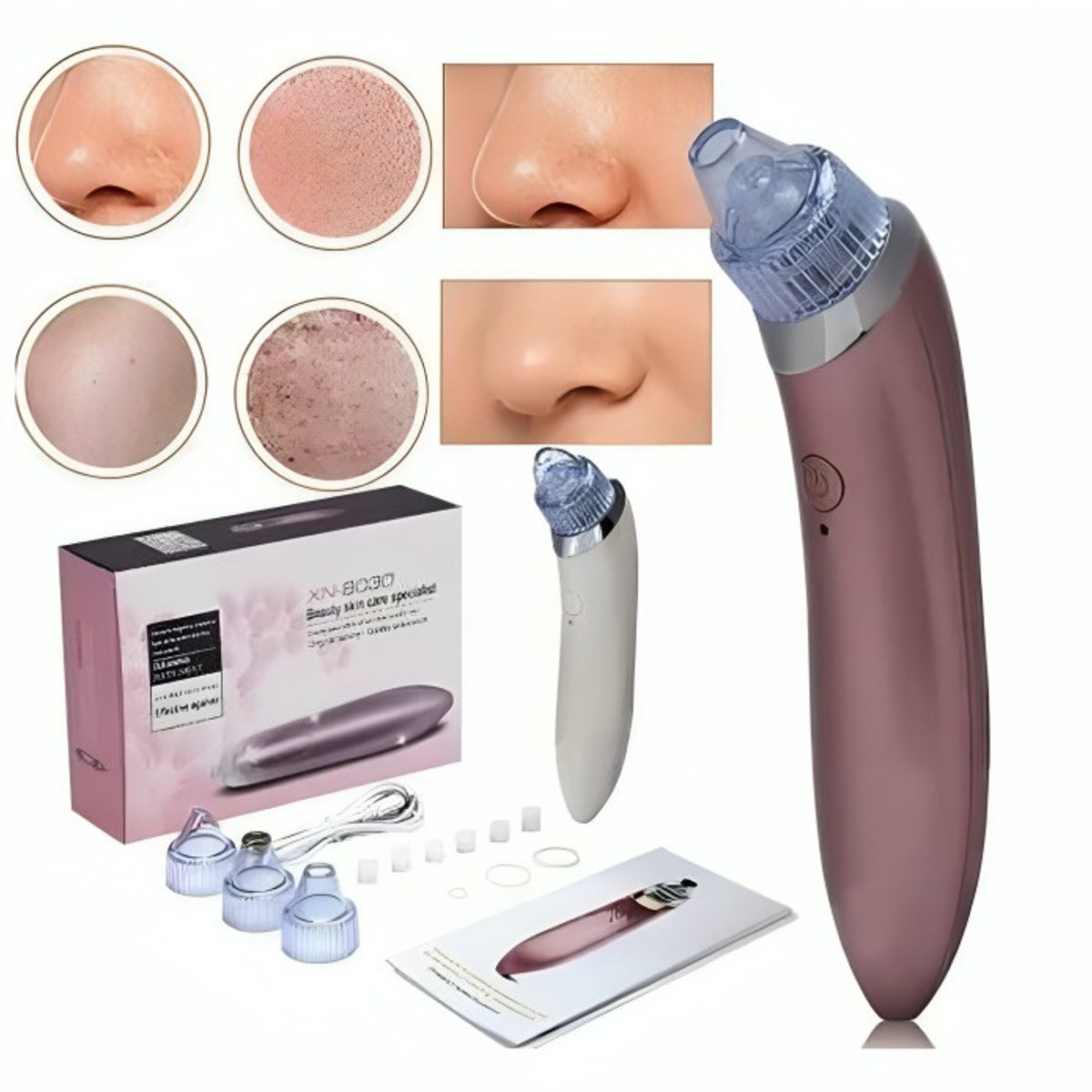 GENERICO - Extractor Removedor De Puntos Negros Espinilla Acne