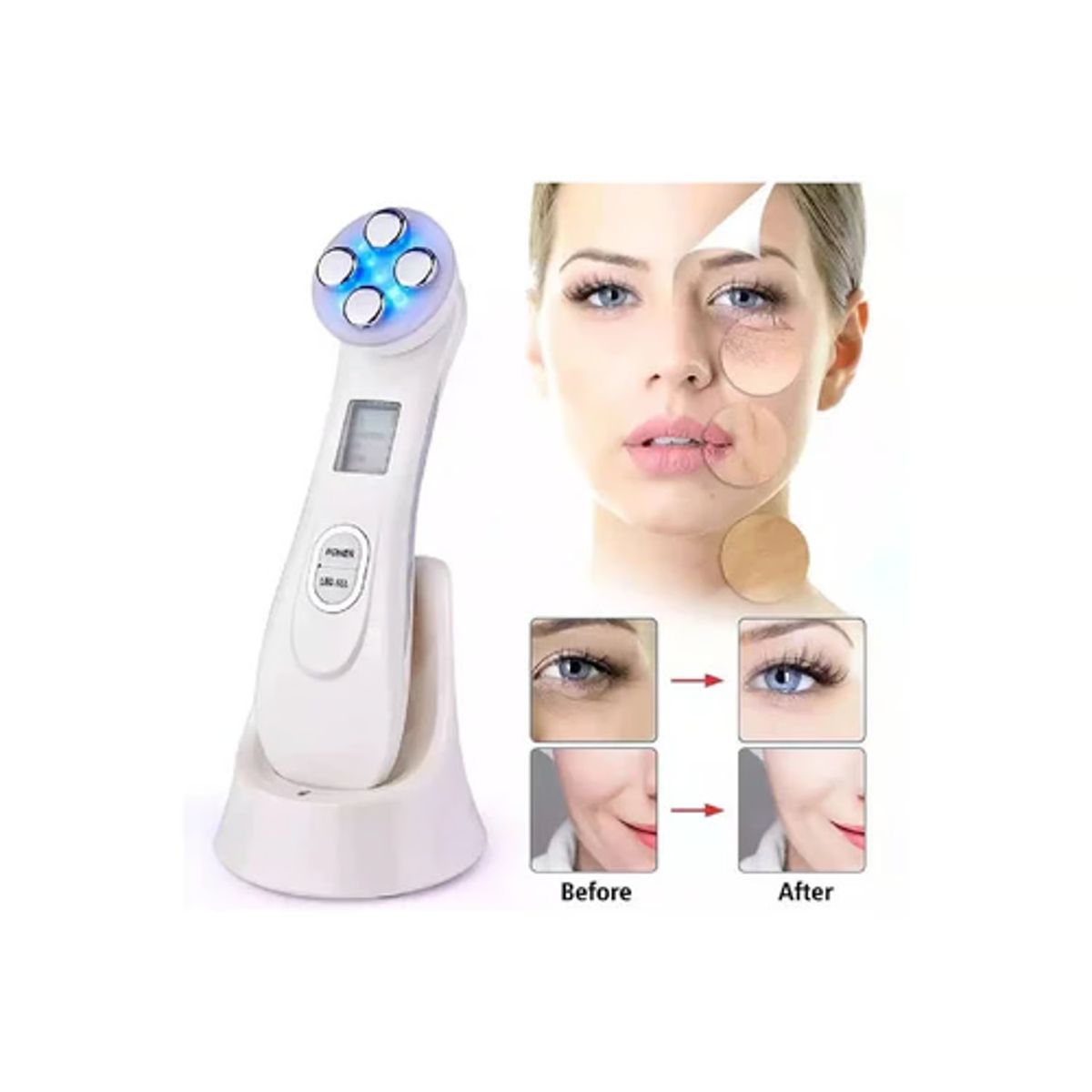 MOVI - RADIO FRECUENCIA FACIL ANTI ARRUGAS LED FOTOTERAPIA