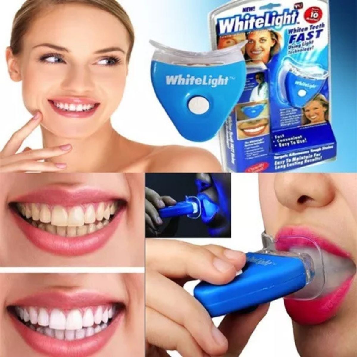 GENERICO - Kit Blanqueador Dental White Light con Luz LED y Gel