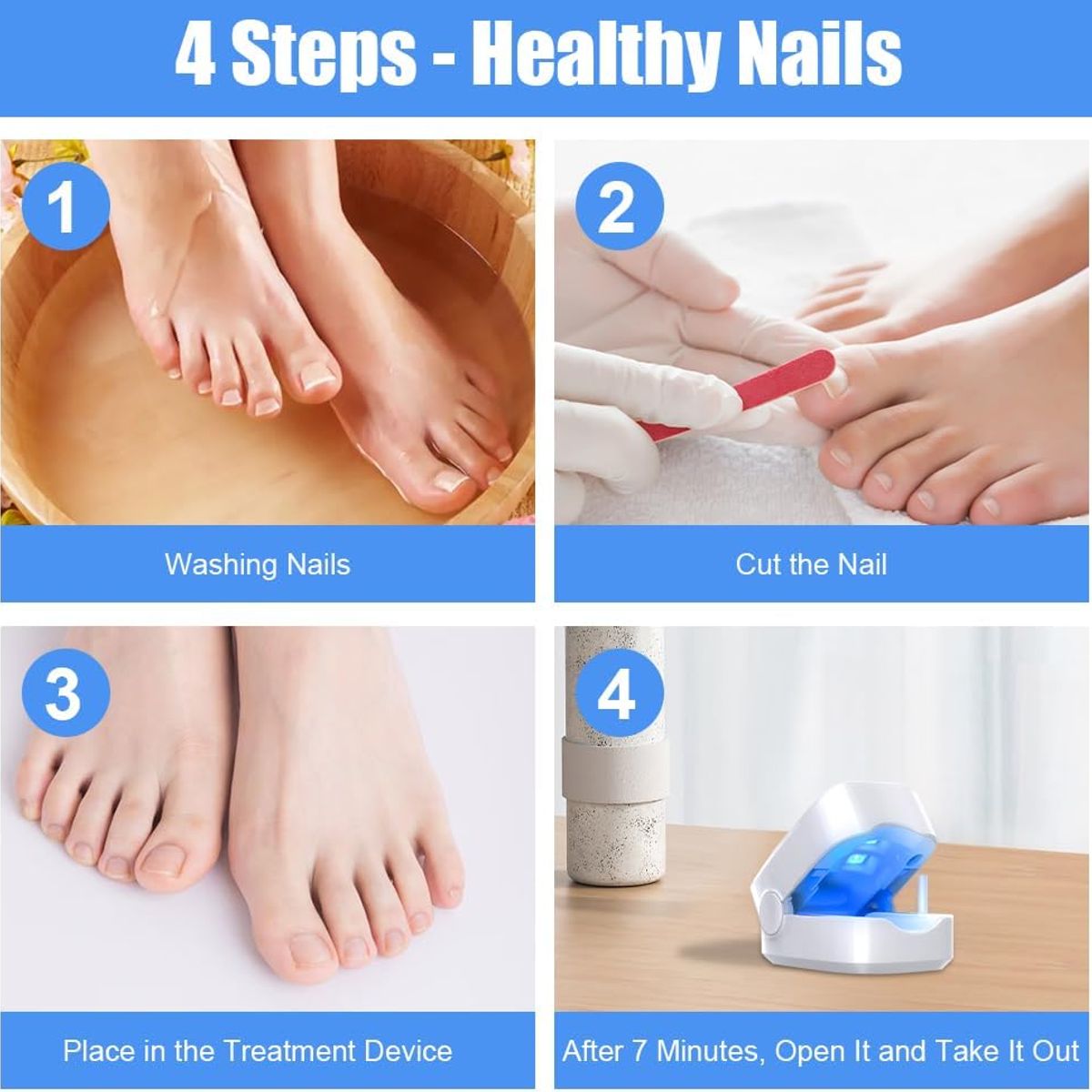 KUANGYE - A Laser Para Quitar Hongos De Las Uñas Onicomicosis