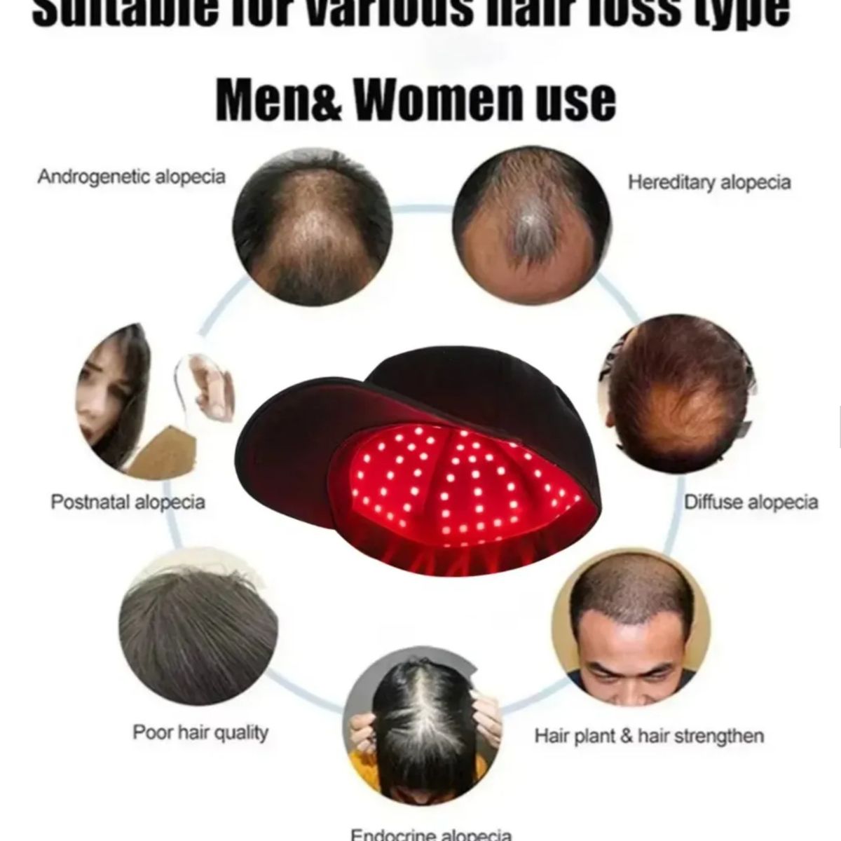 GENERICO - Gorro Terapia Crecimiento Cabello Pelo Alopecia 660nm 850nm