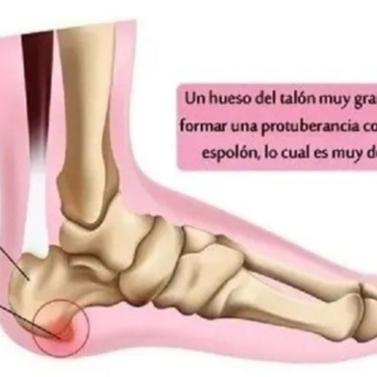 GENERICO - Plantillas Ortopedicas Taloneras Silicona Gel Protector