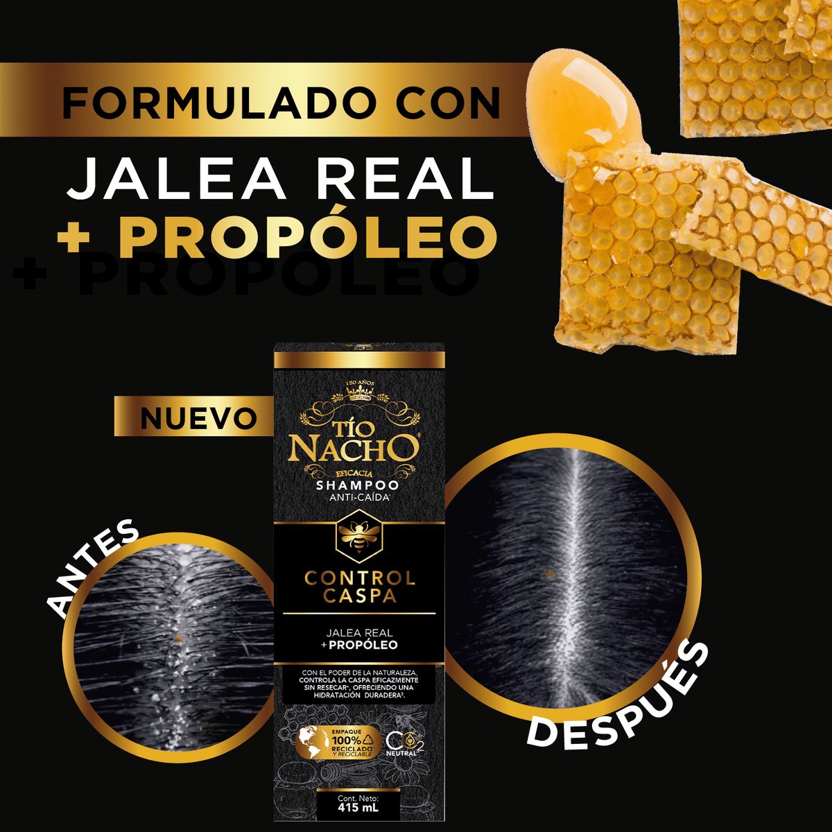 TIO NACHO - Tío Nacho Shampoo Control Caspa 950ml