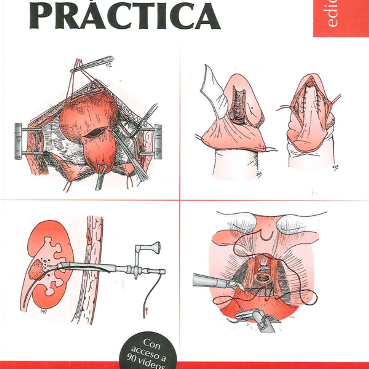 EDITORIAL MEDITERRANEO - Libro Atlas Quirurgico De Urologia Practica 2Ed.