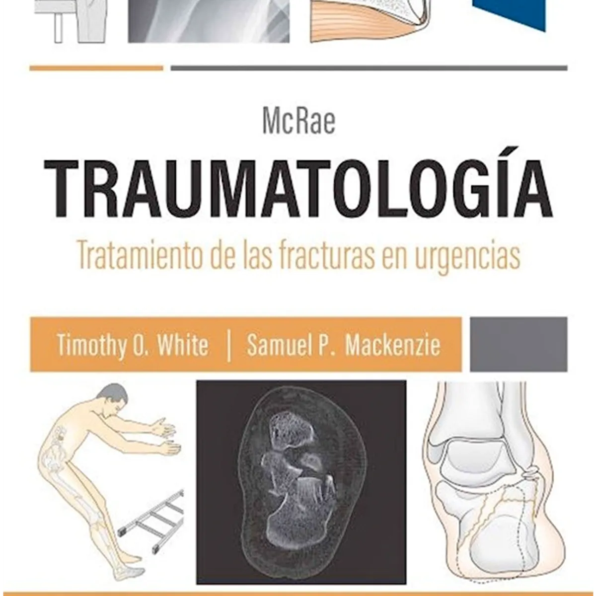 EDITORIAL MEDITERRANEO - Libro Traumatologia. Tto. De Fracturas En Urgencias