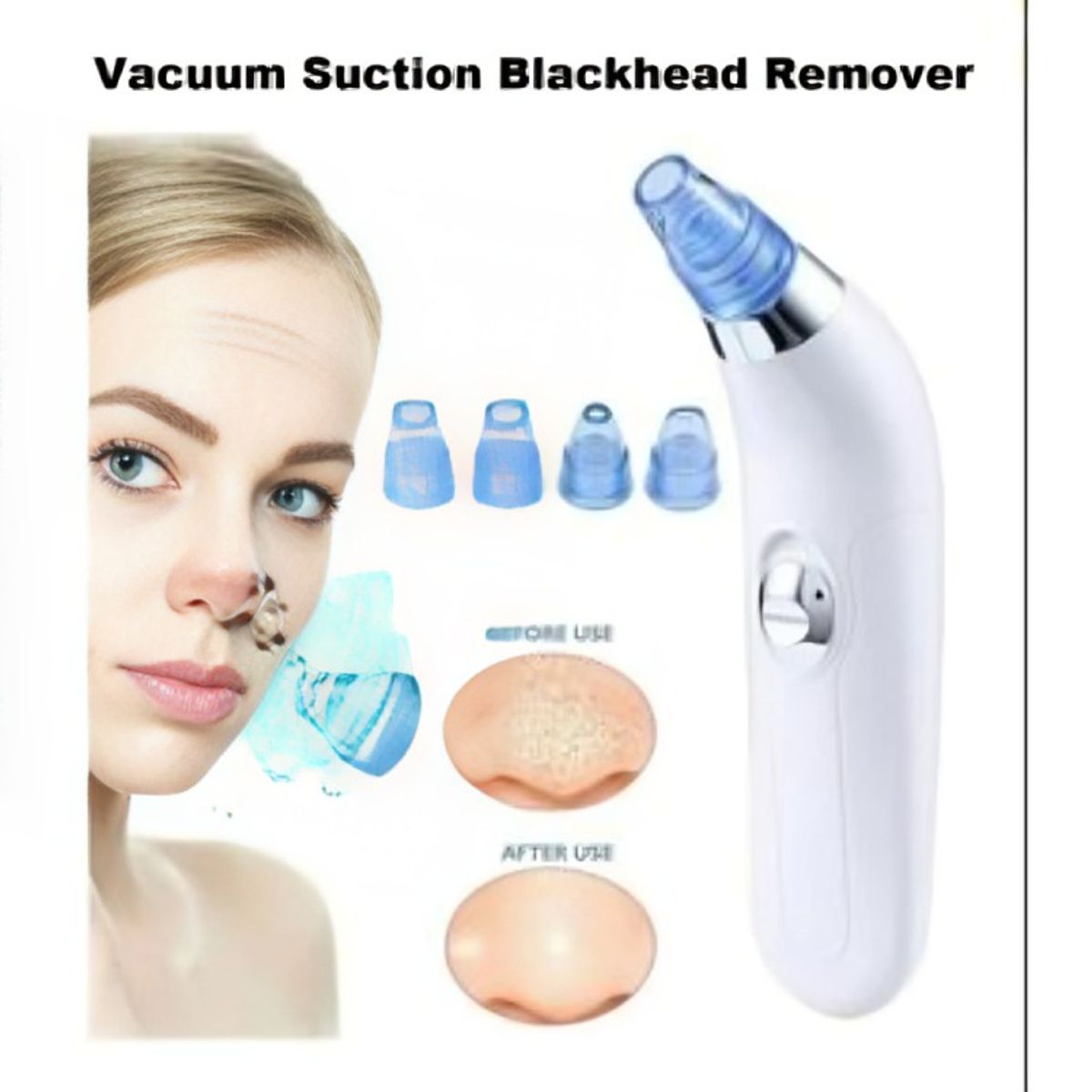 GENERICO - Removedor Extractor Puntos Negros