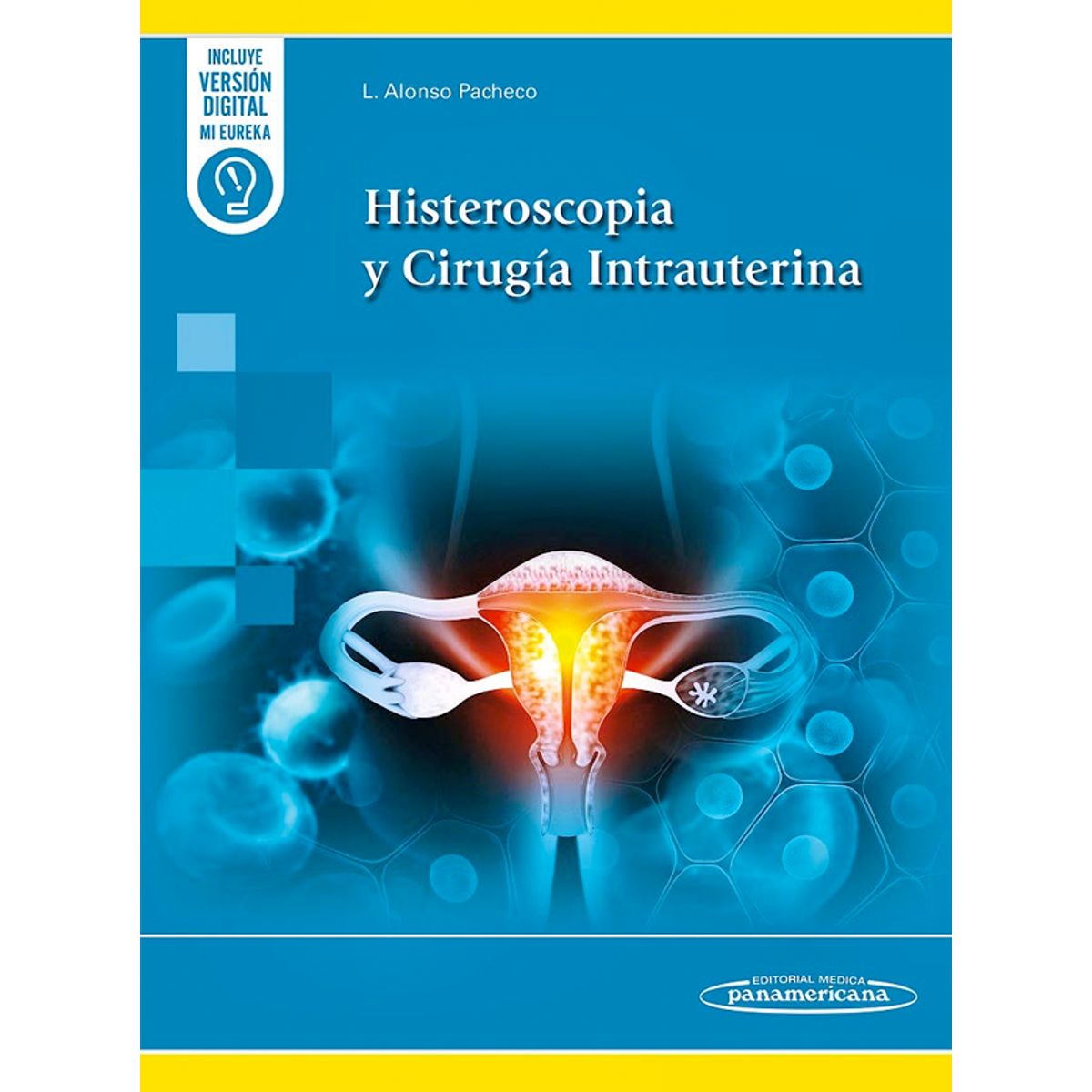 EDITORIAL MEDITERRANEO - Libro Histeroscopia Y Cirugia Intrauterina