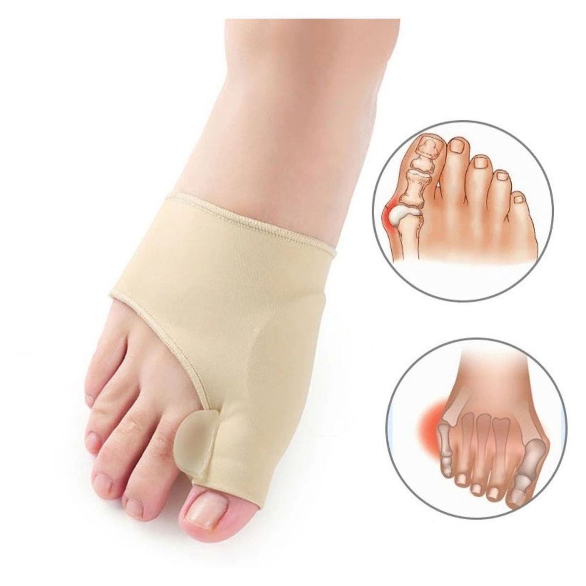 GENERICO - Calcentin Corrector De Juanetes Protector Enderezador