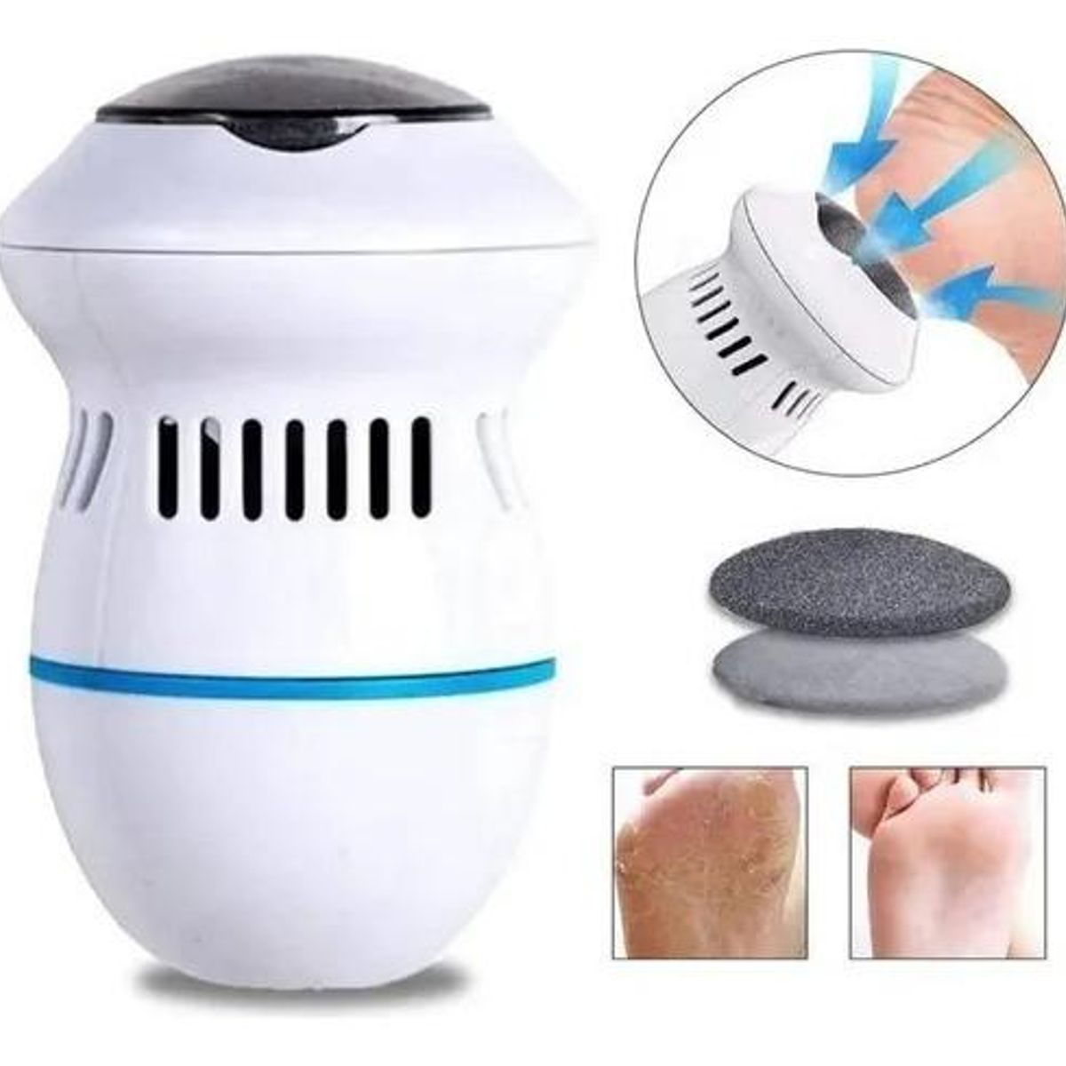 GENERICO - Removedor de Callos Recargable para Pies con Cabezal Intercambiable