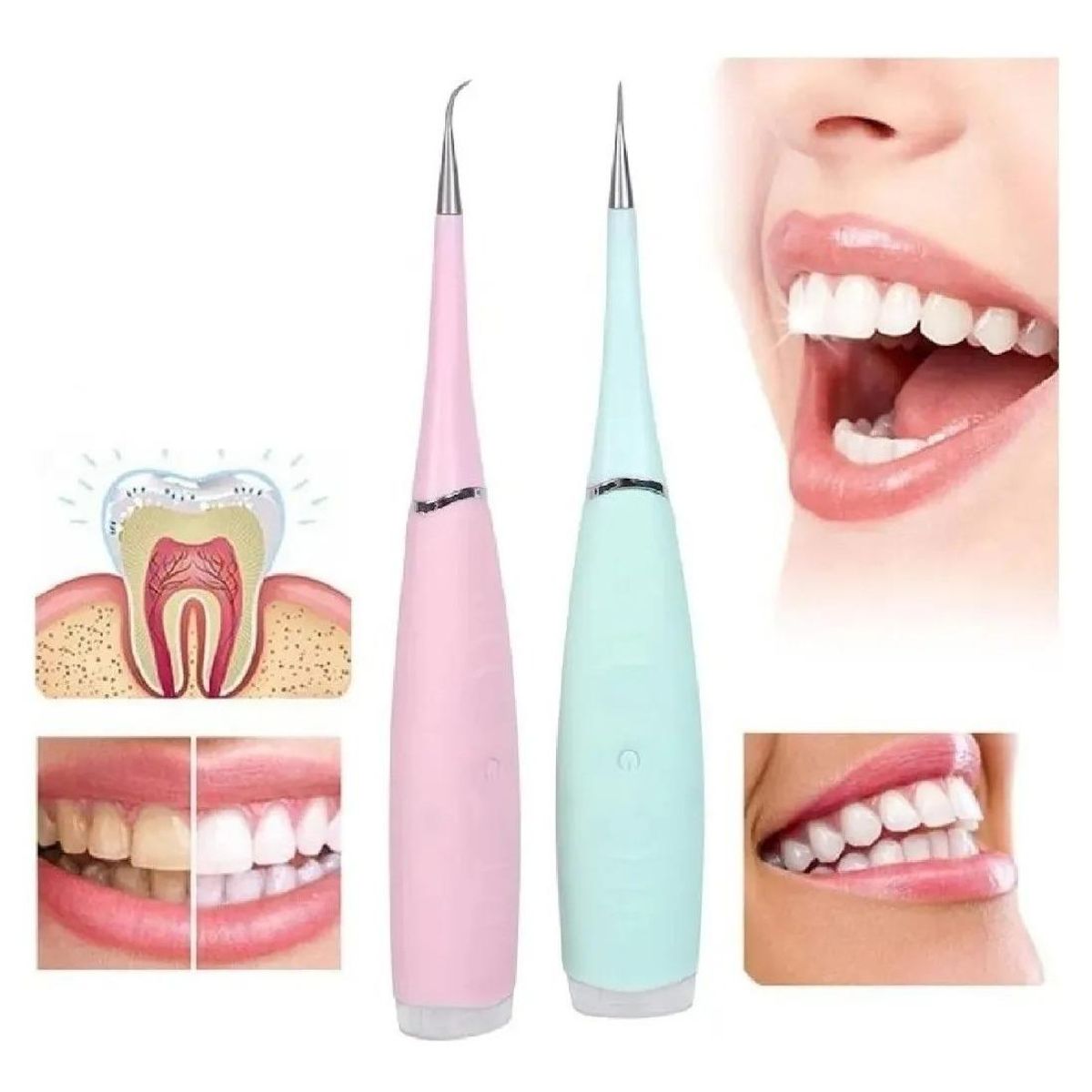 GENERICO - Removedor de Cálculo Dental Eléctrico con 5 Niveles de Limpieza