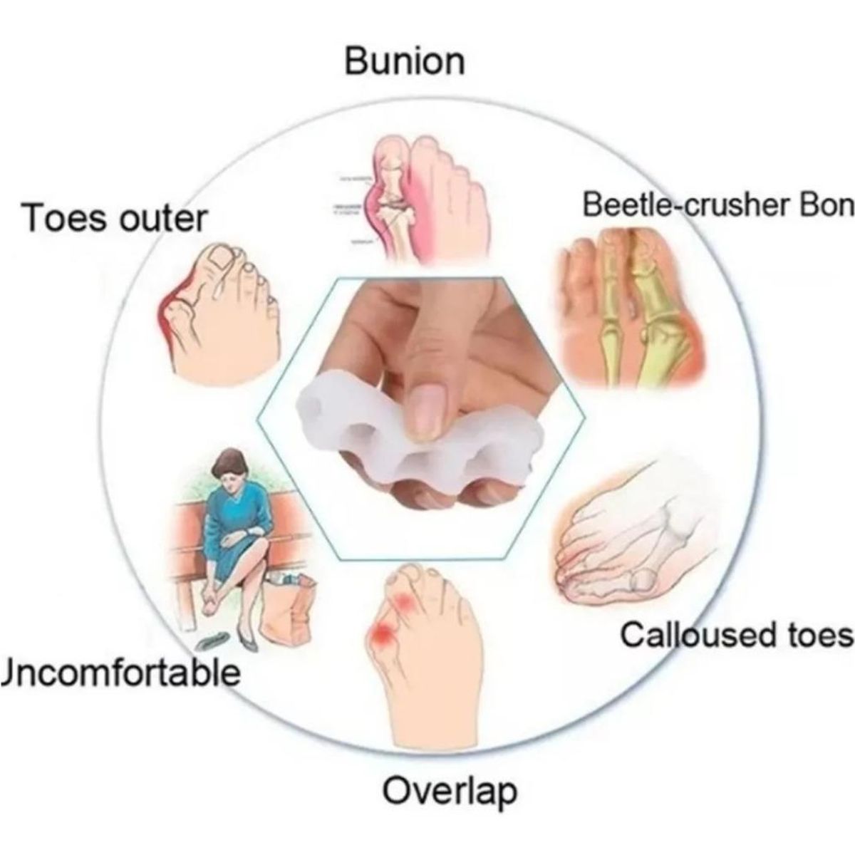 GENERICO - Separador de Dedos Ortopédico de Silicona Suave.-