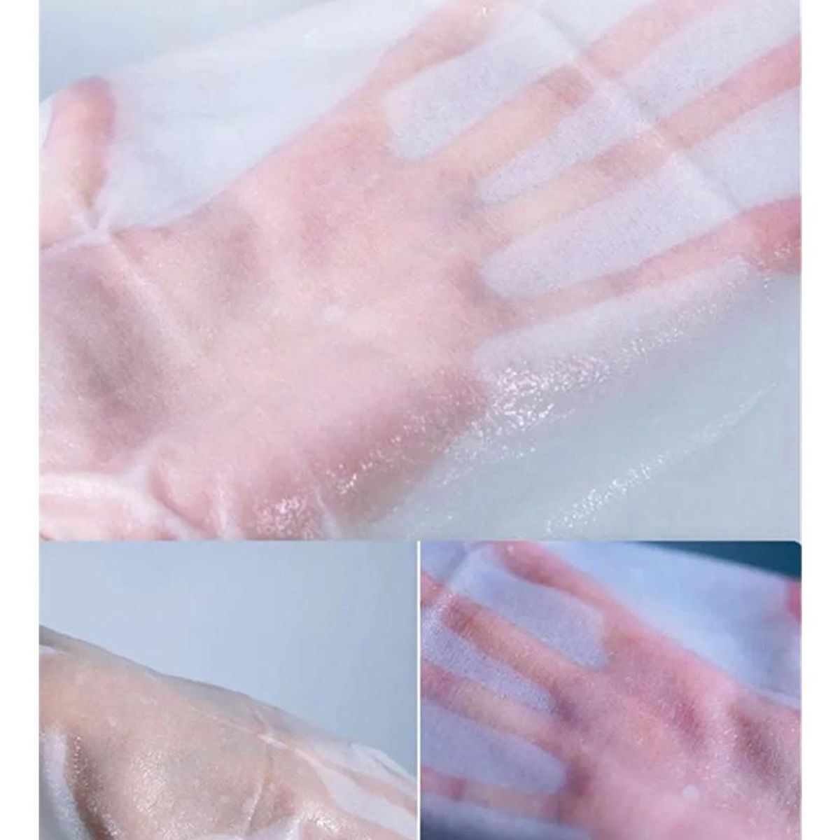 GENERICO - Pack de 10 Membranas Anticongelantes para Criolipólisis