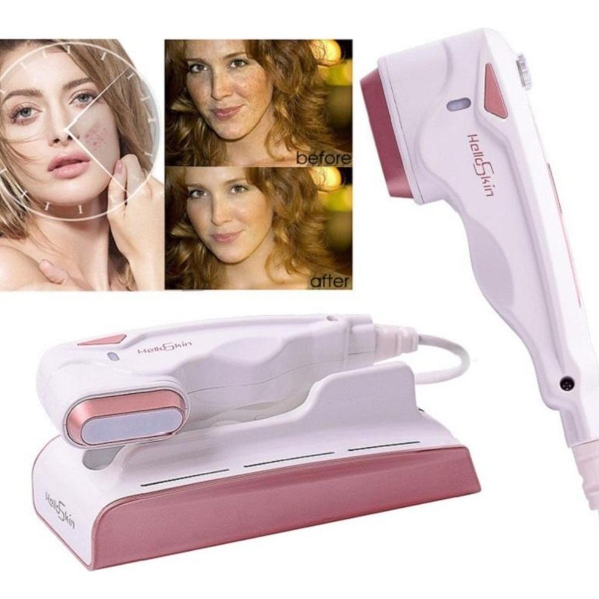 GENERICO - Máquina de Radiofrecuencia Facial Antiarrugas Ajustable