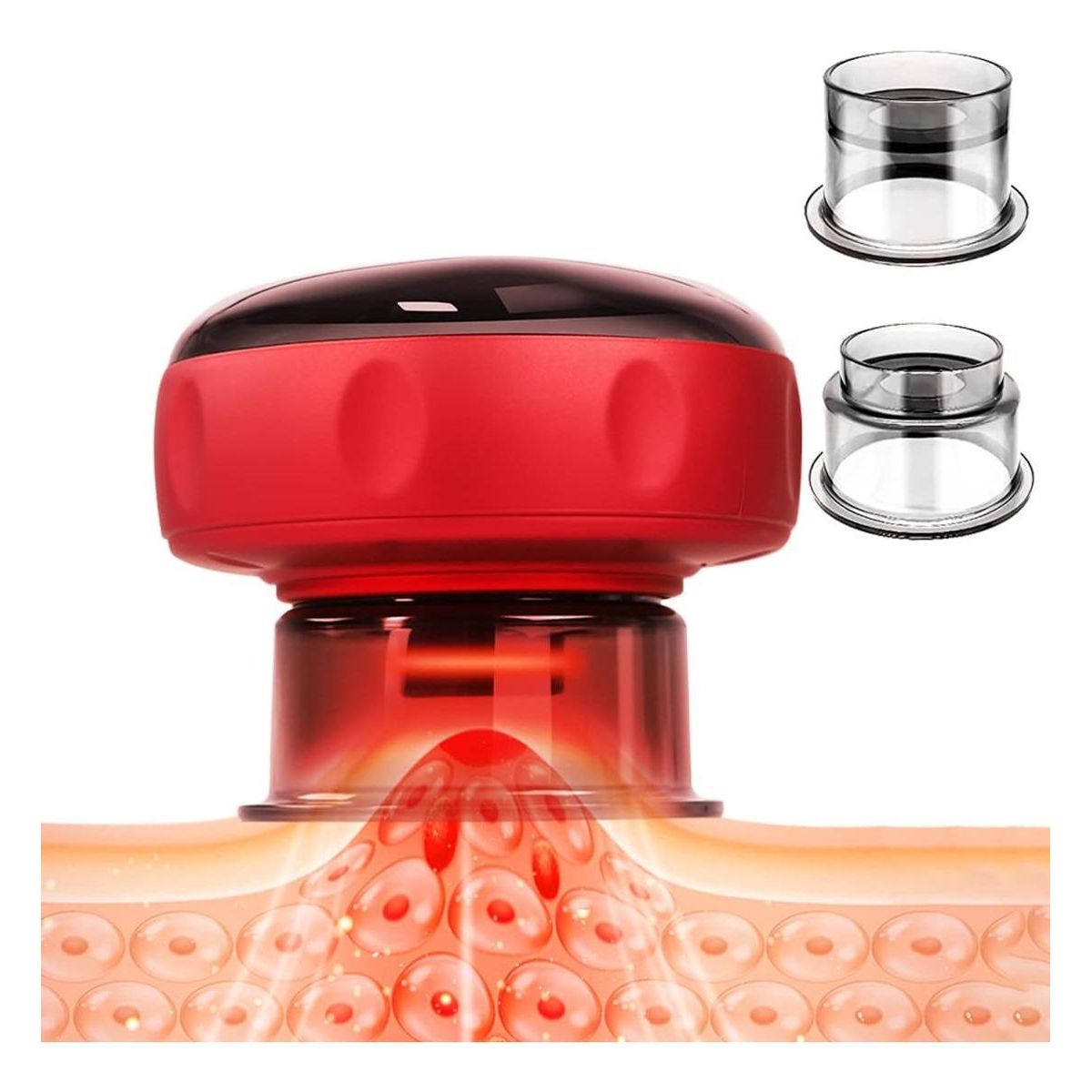 GENERICO - Masajeador Electrico de Ventosas para Reducción de Celulitis