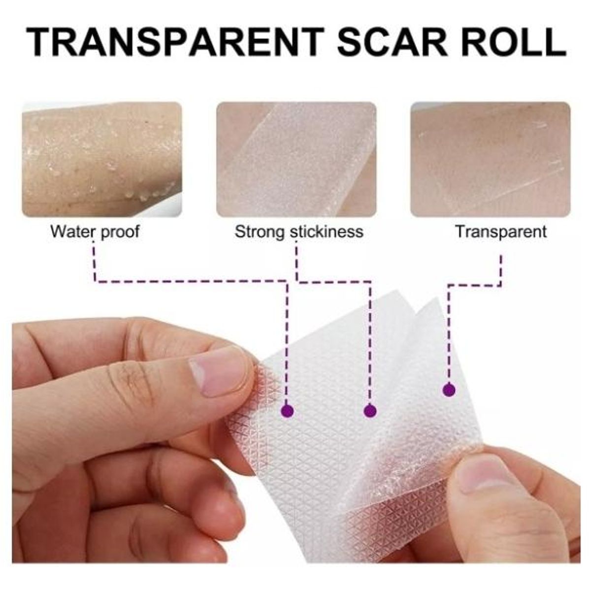 GENERICO - Parche de Silicona Médica para Cicatrices Hipertróficas y Queloides