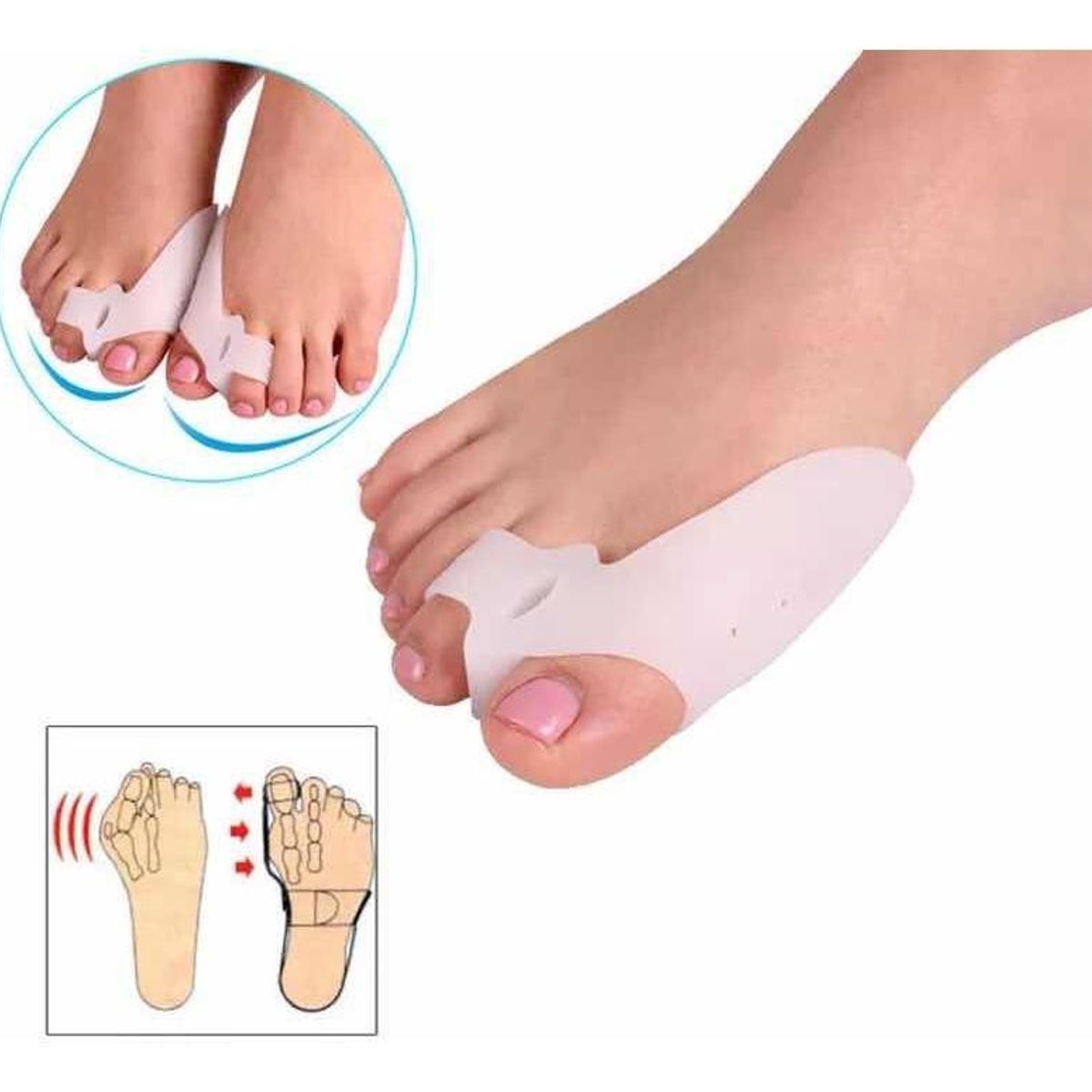 GENERICO - Separador Corrector de Juanetes para Dedos del Pie.-