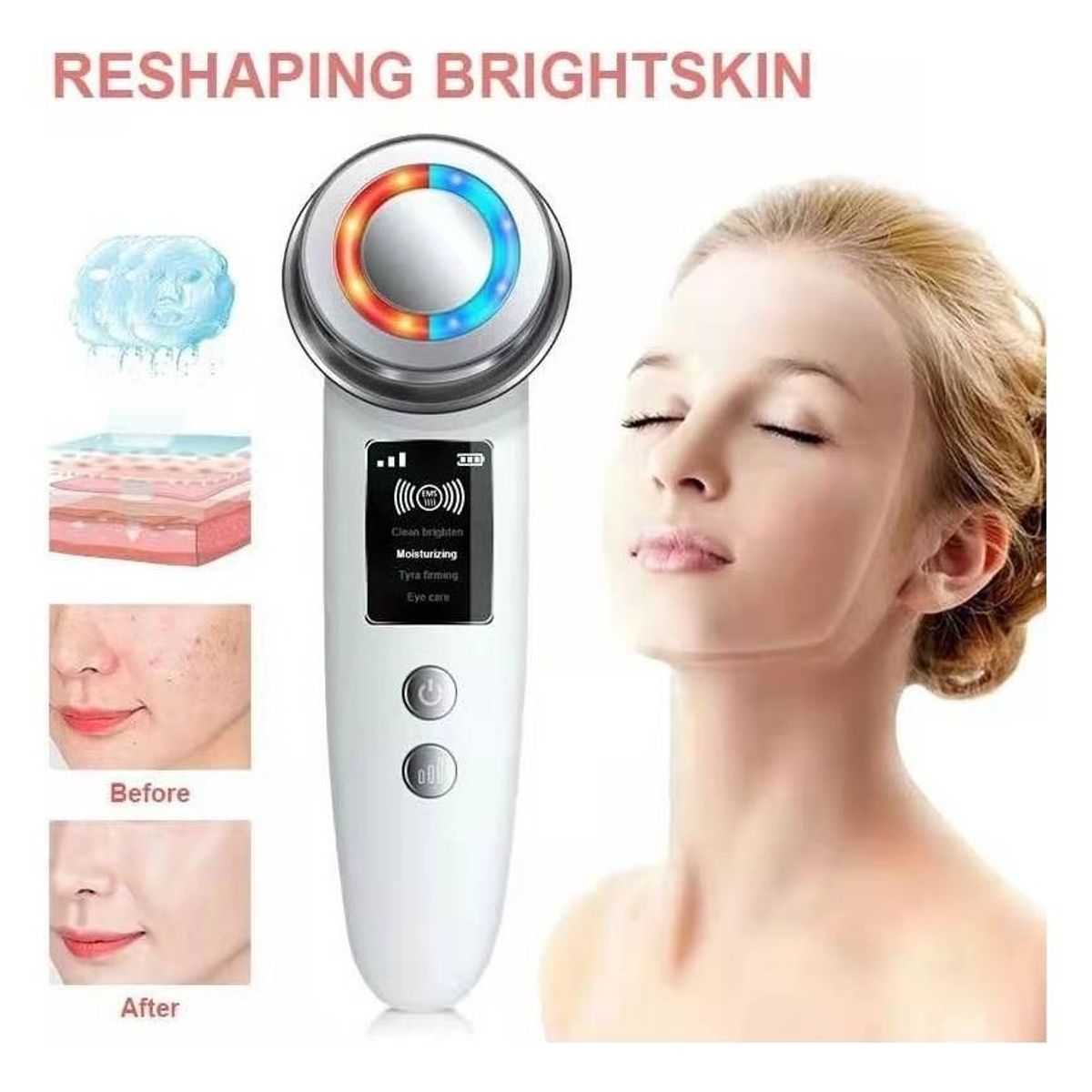 GENERICO - Máquina de Elevación Facial para Rejuvenecimiento de Piel