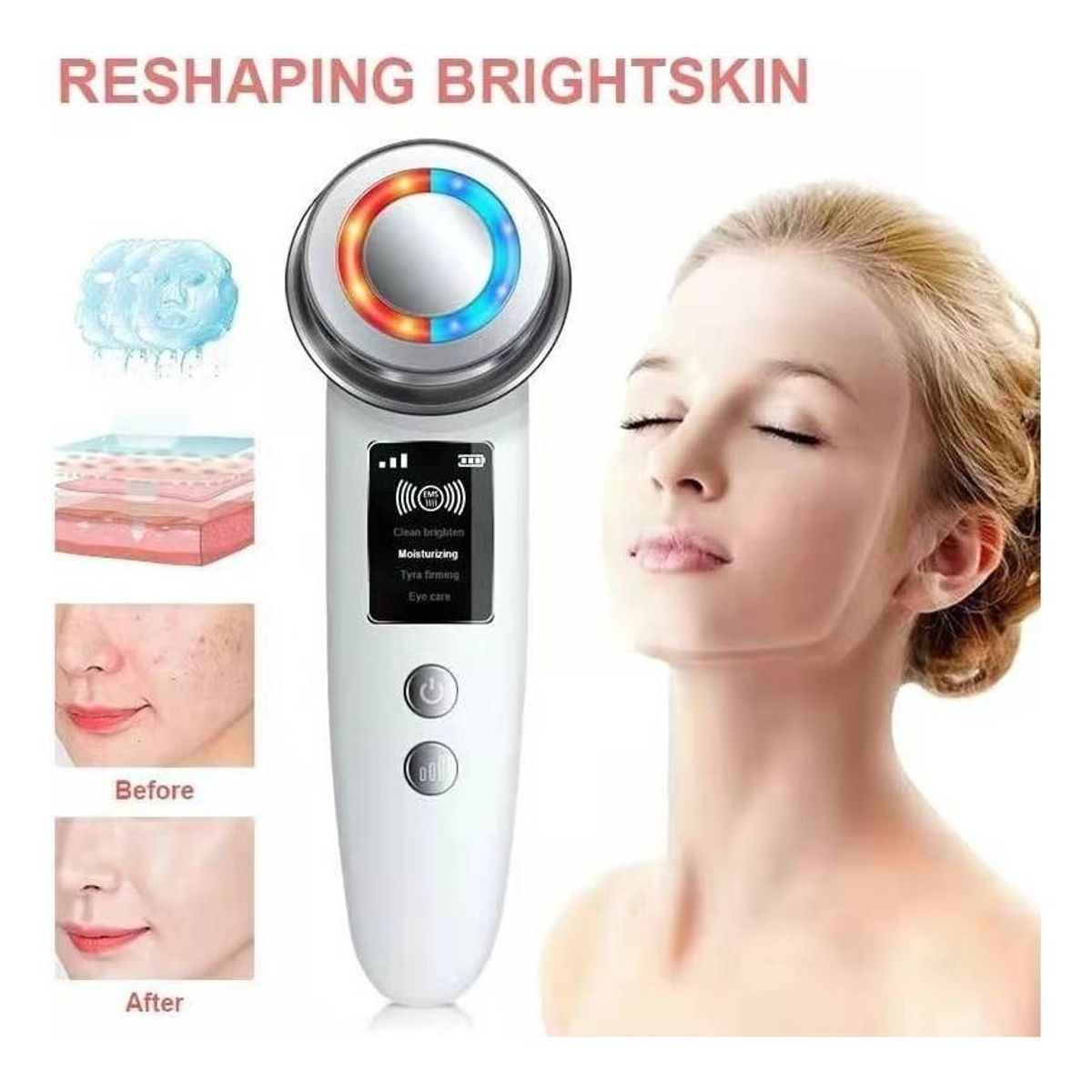 GENERICO - Máquina de Elevación Facial para Rejuvenecimiento de Piel