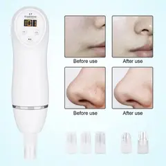MOVI - DIAMOND PEELING LIPIADOR CON DERMO ABRASION