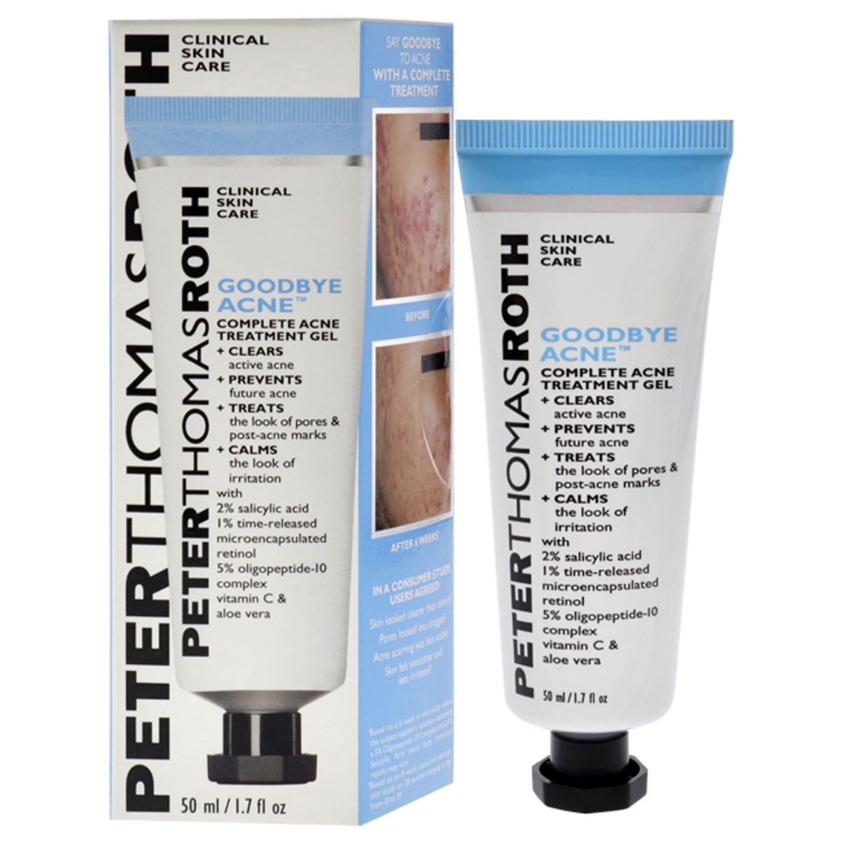 PETER THOMAS ROTH - Gel Completo de Tratamiento Acne Good Bye 50ml Peter Thomas Roth