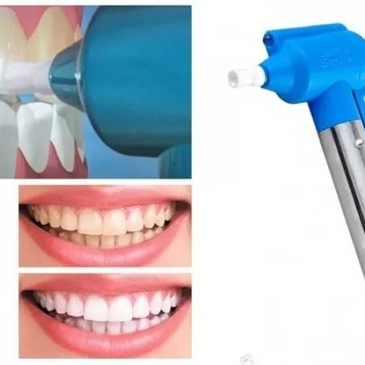 MOVI - Pulidor Blanqueador Dientes Luma Smile