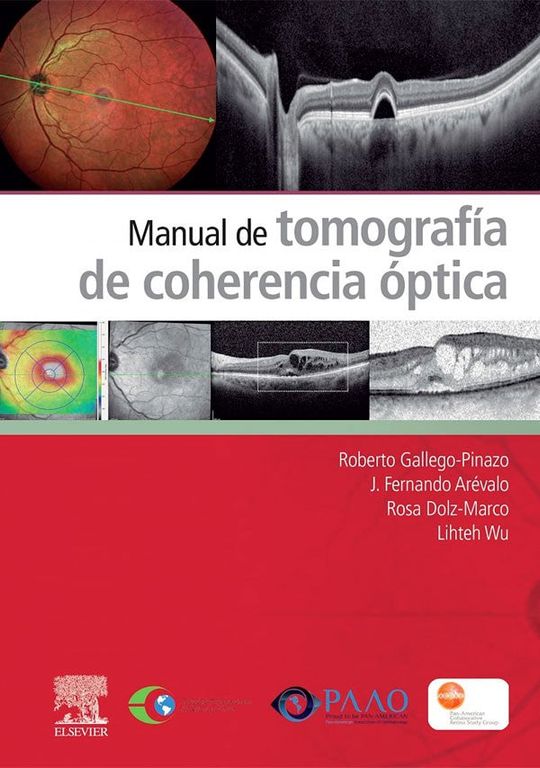 Libro Manual De Tomografia De Coherencia Optica