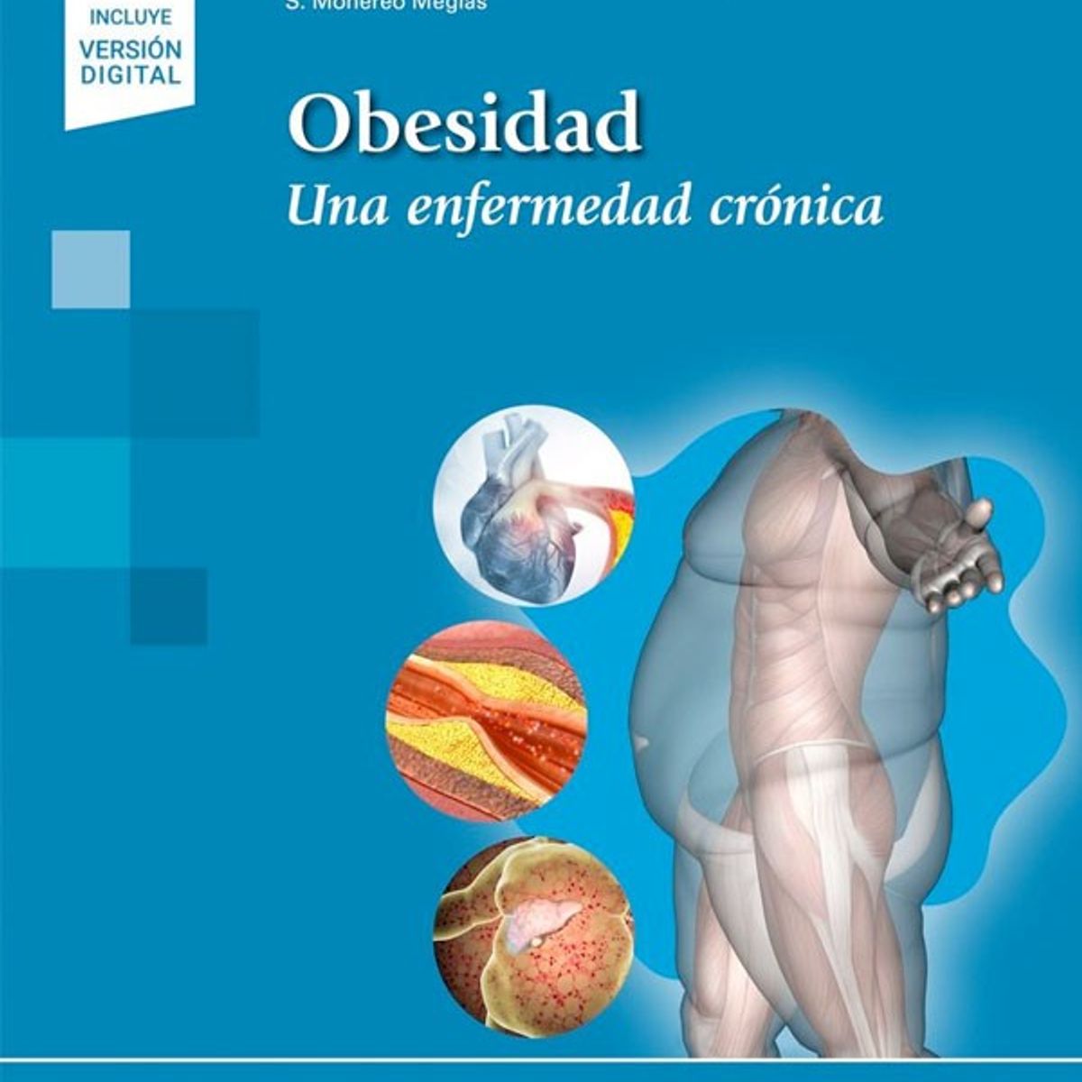 EDITORIAL MEDITERRANEO - Libro Seedo. Obesidad Una Enfermedad Cronica + E