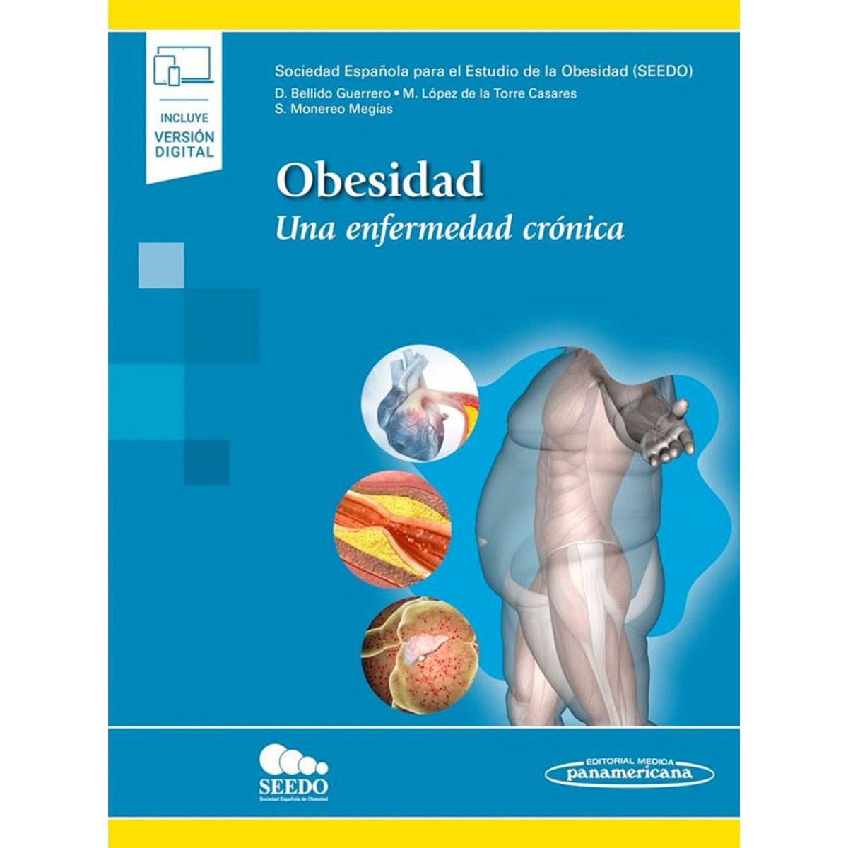 EDITORIAL MEDITERRANEO - Libro Seedo. Obesidad Una Enfermedad Cronica + E
