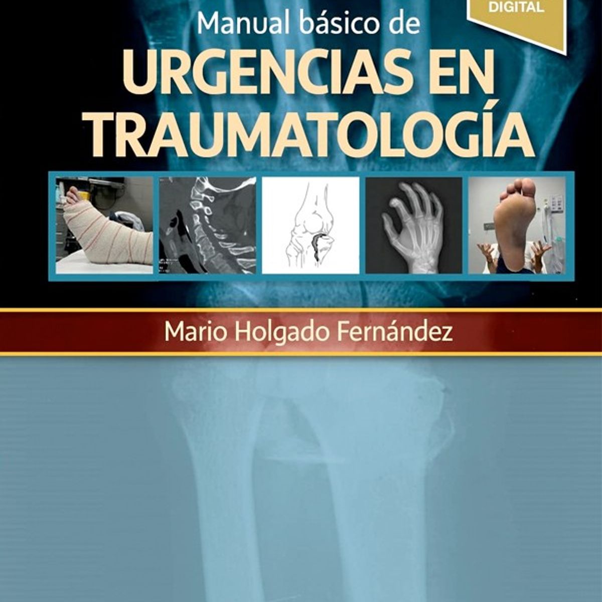 EDITORIAL MEDITERRANEO - Libro Manual Basico De Urgencias En Traumatologia