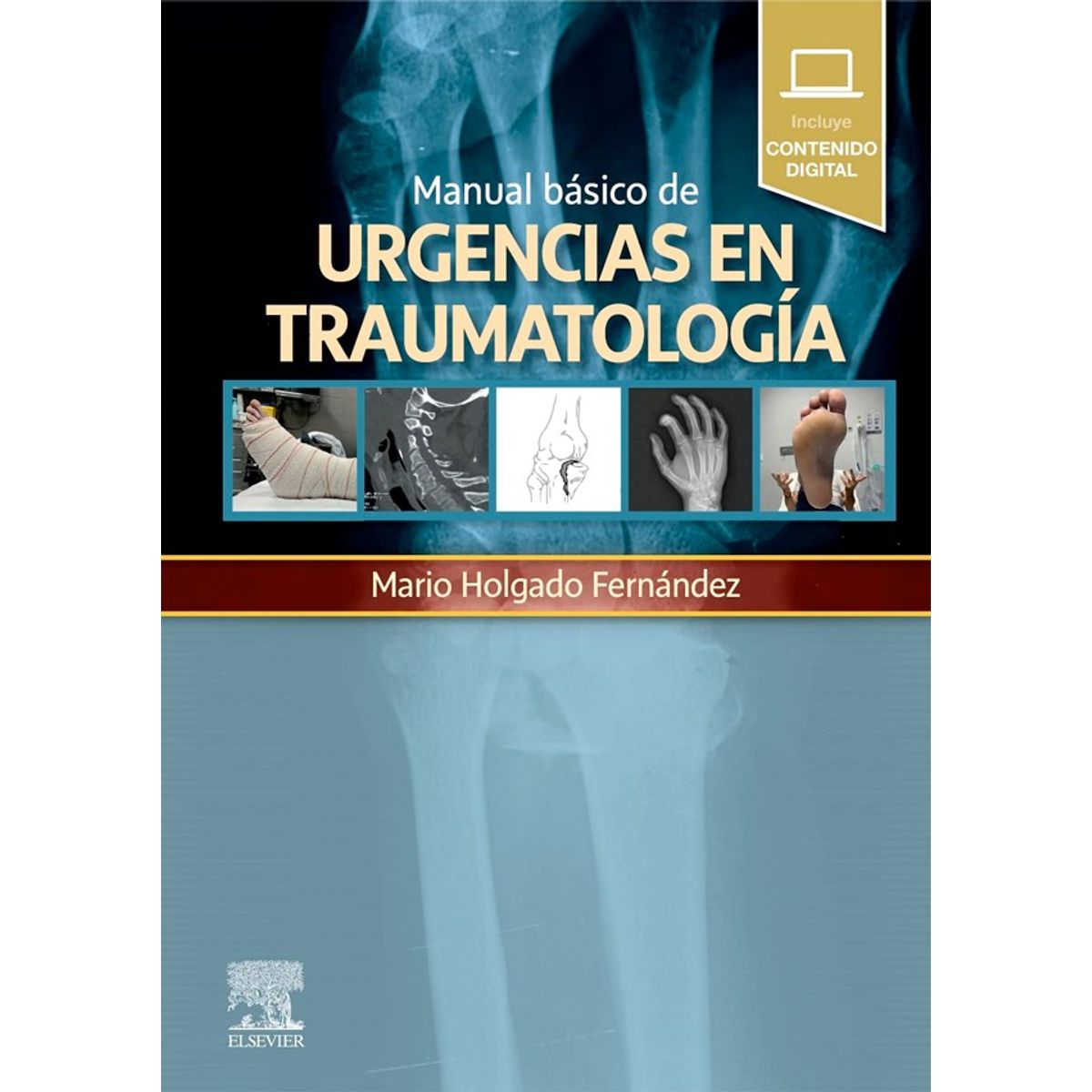 EDITORIAL MEDITERRANEO - Libro Manual Basico De Urgencias En Traumatologia