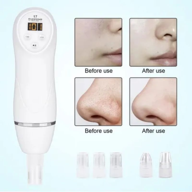 MOVI - DIAMOND PEELING LIMPIADOR CON DERMO ABRASION